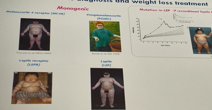 A genética da obesidade
